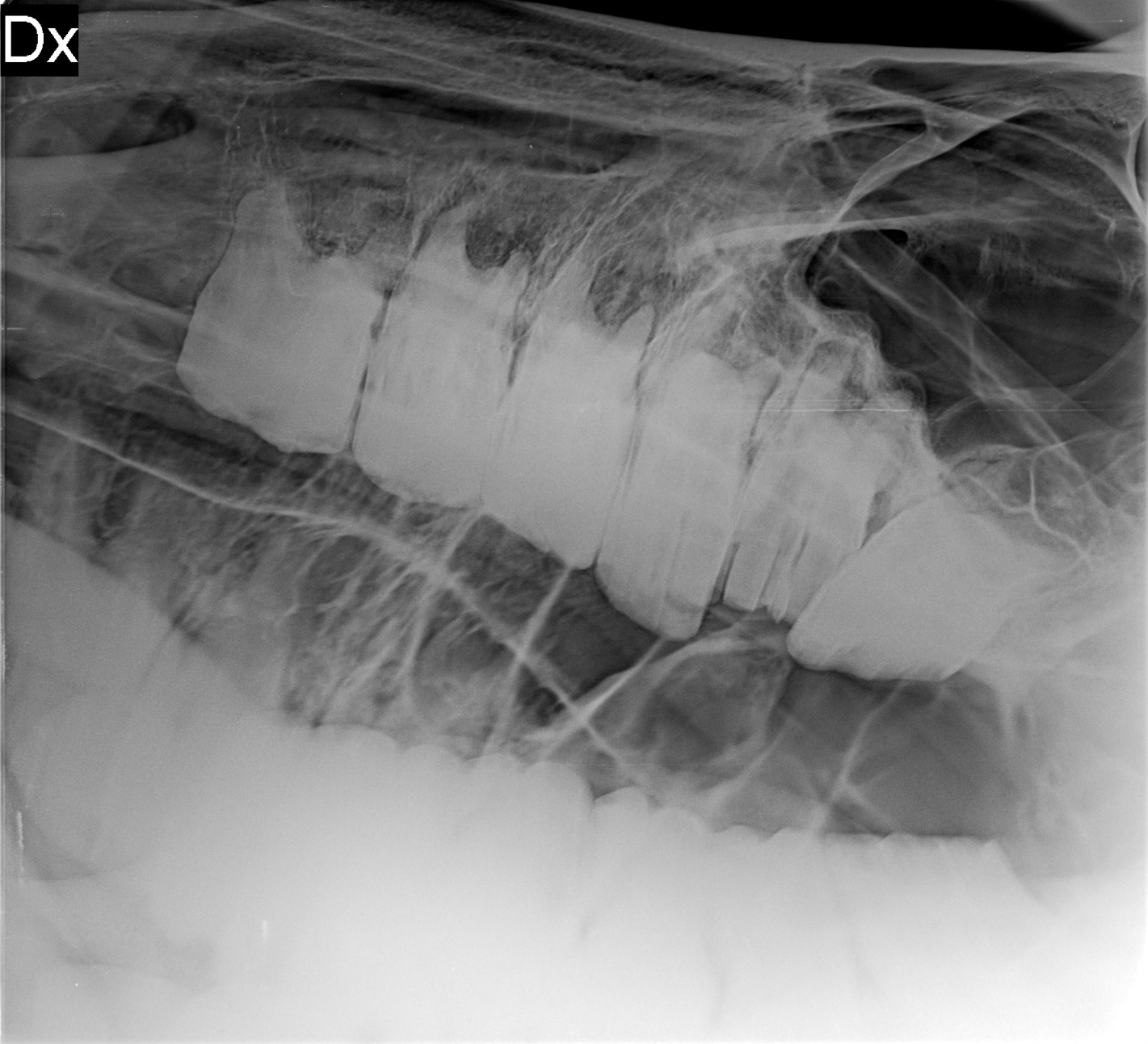 Stolička před extrakcí (druhý zub zprava)